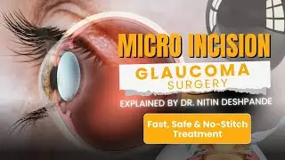 Micro Incision Glaucoma Surgery Explained by Dr. Nitin Deshpande | Fast, Safe & No-Stitch Treatment