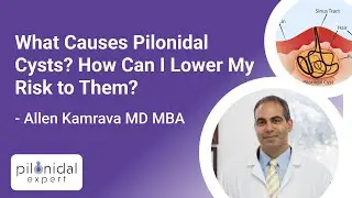 What Causes Pilonidal Cysts? How Can I Lower My Risk to Them? | Pilonidal Expert