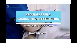 Third Molar (Wisdom Tooth) Extraction Post Operation Home Care