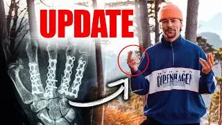 HAND FUTSCH!? - 2 Monate nach OP VERLETZUNGSUPDATE