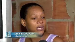 Gêmeas Siamesas nascem ligadas pelo tórax em Sergipe - JORNAL DO ESTADO