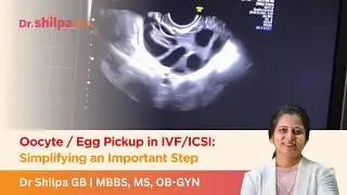 Oocyte / Egg Pickup in IVF/ICSI: Simplifying an Important Step | Dr. Shilpa GB