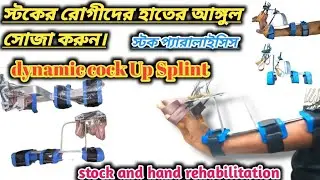 Radial Nerve Palsy dynamic Cock Up Splint. স্টক প্যারালাইসিস রোগীর হাতের আঙ্গুল সোজা করার স্প্রিন্ট