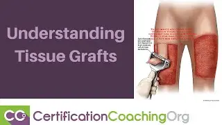 Understanding Tissue Grafts