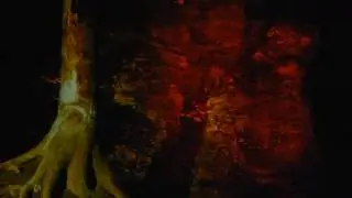 Foresta Lumina - Coaticook, QC - August 2016