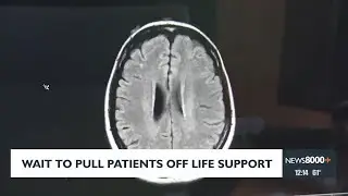 Study suggests patients with traumatic brain injury should not be taken off of life support so