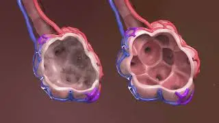 Production of Educational 3D Animation on COPD and lung function