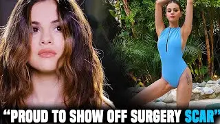 Selena Gomez proud to SHOW OFF her Kidney Transplant Surgery Scar!