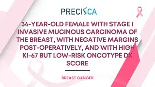 Expert Cancer Panel: Stage I invasive mucinous breast carcinoma w/ high Ki-67 but low Oncotype DX