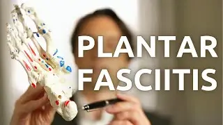 PLANTAR FASCIITIS - About this heel pain, the causes, how to examine and diagnose.