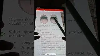 Ch 2 pt 1 preoperative evaluation and management,General surgery dogar, complete quick review
