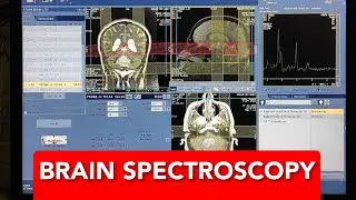 Brain Spectroscopy protocol, positioning and planning on GE 1.5 Tesla | Live Demo.