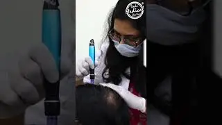 Safe, painless and reliable hair regrowth treatment| Dadu Medical Centre