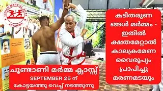 കടിതരുണങ്ങൾ മർമ്മം - ഇതിൽ ക്ഷതമേറ്റാൽ കാലക്രമേണ വൈരൂപ്യം പ്രാപിച്ചു മരണമടയും