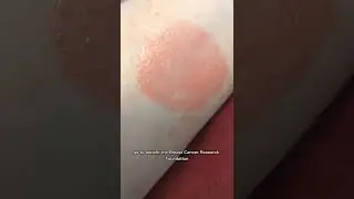 Choosing Hope Super Fruit Lip Mask to benefit the BCRF Silk Naturals