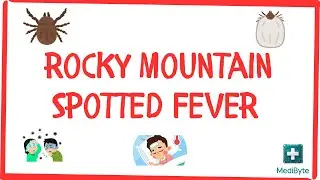 What is Rocky Mountain Spotted Fever (RMSF)? 🕷️
