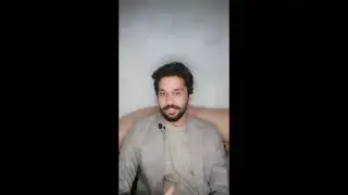 Alien hand syndrome / anarchic hand syndrome/ doctor strange love syndrome/rare disorders