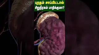 புரதம் சாப்பிட்டால் சிறுநீரகம் பாதிக்குமா? | Does eating protein affect the kidney? |  Dr Arunkumar