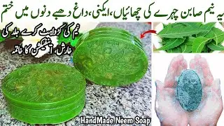 Homemade NEEM SOAP For Bright, Spotless And Acne Free Glowing Skin✨️| Whiten Dull Dark Rough Skin