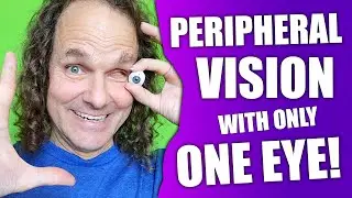 I Lost My Eye to Cancer - Peripheral Vision Loss After Losing My Eye - Test Your Peripheral Vision