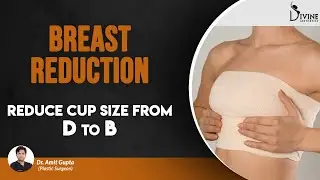 Best way to Reduce Cup Size from D to B with Breast Reduction | Dr. Amit Gupta