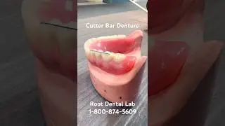 Auto Balancing Cutter Dentures #dentistry #dentallab #dentures #dentalrestoration #oralsurgery
