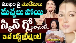 ANOO'S:  PIMPLES, మచ్చలు పోయి స్కిన్ GLOW అవ్వాలంటే | Skin Care | CH Anuradha | SumanTv Keerthi