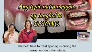 SPACES SA NGIPIN…PAANO NA?