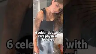 6 celebrities with rare physical features #celebrity #shortvideo