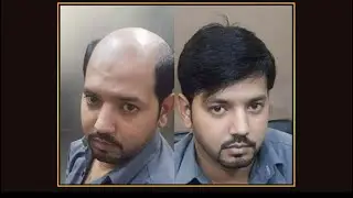 Hair patch original human hair supplier in ulhasnagar kalyan dombivali 9075156688