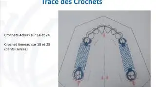 Traces Types : CI III - CI I Maxillaires