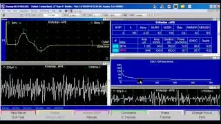 Synergy MUNIX Demo