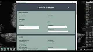 Tutorial Pengisian Report Invenia ABUS 2.0