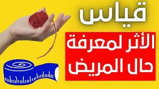 قياس الاثر لمعرفة حال المريض للشيخ عبدالرحمان السيراجي