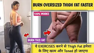 Burn Oversized Thigh In 1 Week Challenge | Thigh Fat Burning Exercises | Thigh Fat loss
