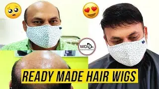 hair patches for men | Natural Hair system for men | Non Surgical hair replacement in Bangalore