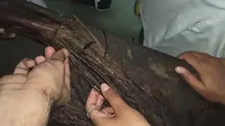 প্যালমারিস লংগাস ও অন্যান্য ফোরআর্ম মাসল | Palmaris Longus & Other Forearm Muscles (Bangla) SSMC