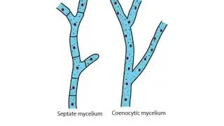#coenocytic#hyphae#fungi#mycelium#animal#kingdom#11 biology#NEET❤💯👍️#msk#biology