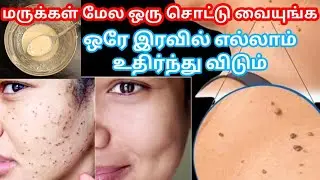 ஒரே இரவில் மருக்கள் உதிர / Remove Skin Tag / Maru poga Tips In Tamil
