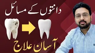 You might not have seen a unique way to whiten yellow teeth  | Teeth Cleaning in only 5 Minutes