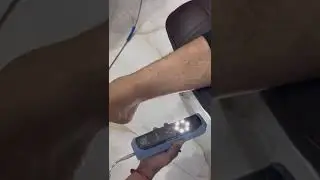 Foot scan using Einstar 3d Scanner