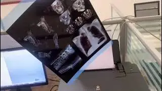 inkjet x ray film printed by Canon printer