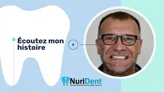 Implants Basaux et Ensemble complet de nouvelles dents