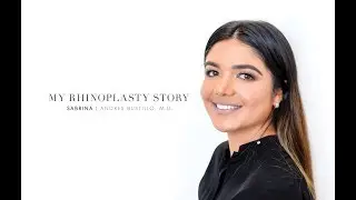 Rhinoplasty performed on a female patient | Andres Bustillo, M.D. | Miami, Fl.