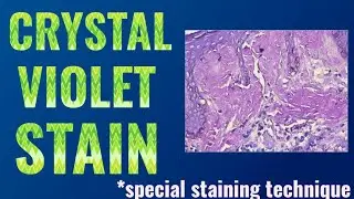 Crystal Violet Stain