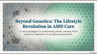 Protect Your Vision: Lifestyle Changes That Support AMD Eye Health