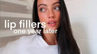 lip fillers - one year later