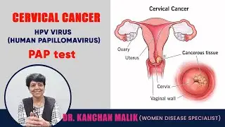 CERVICAL CANCER SCREENING/PAP TEST/HPV TEST : DR.KANCHAN MALIK