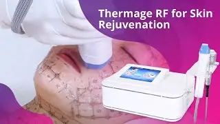 Professional Fractional RF Radio Frequency Dot Matrix Cooling Machine
