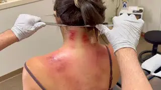 ULTIMATE CRUNCH AND TOXIN REMOVAL